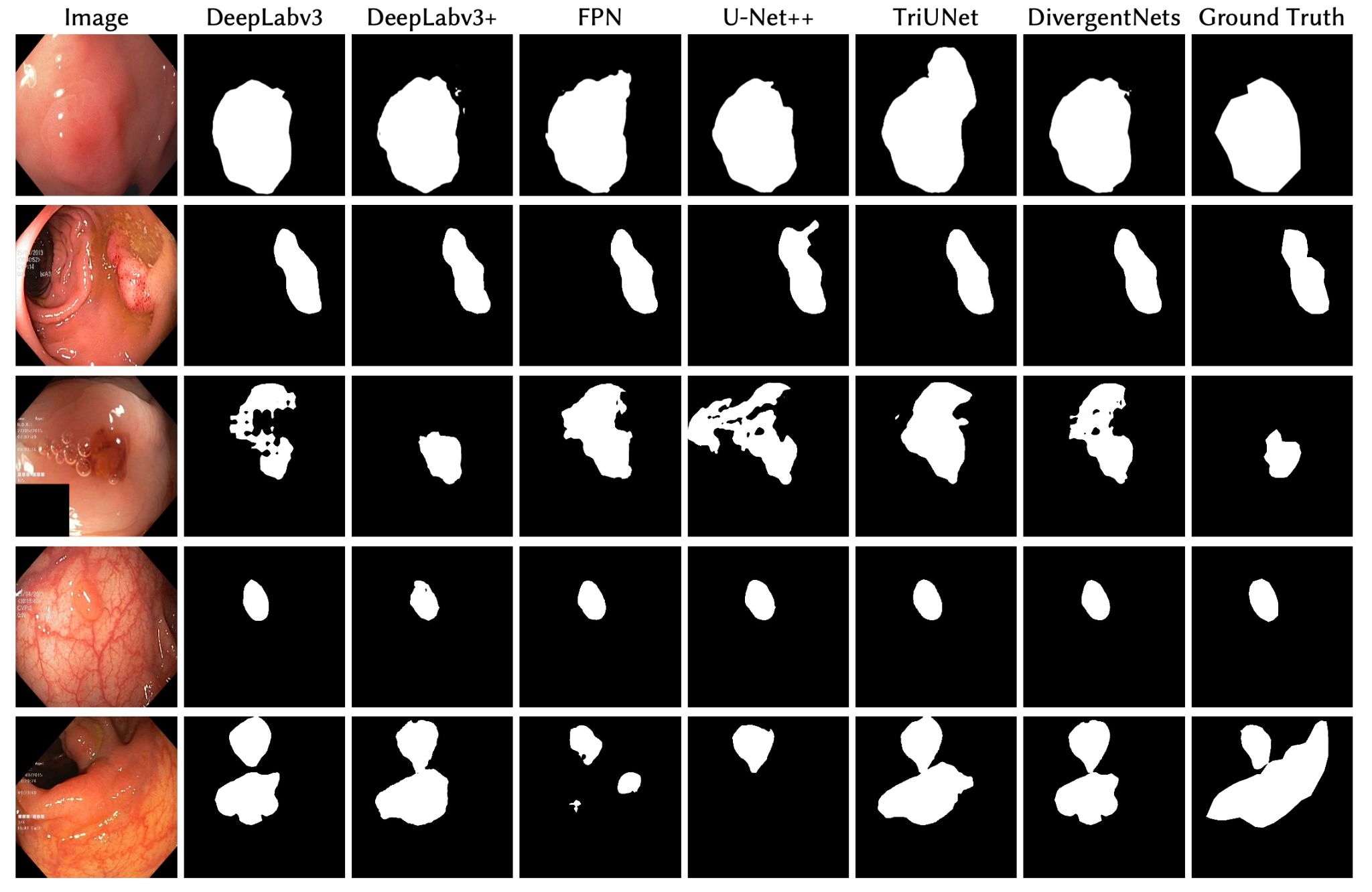 Deep Convolutional Neural Networks - Slidev